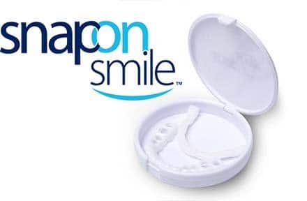 Snap-on Smile यह क्या है?